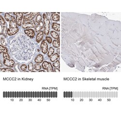 MCCC2 Antibody, Novus Biologicals 0.1mL; Unlabeled:Antibodies, Polyclonal
